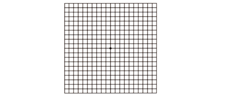 Macular-degeneration