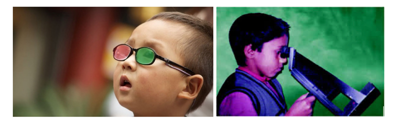 children-eye-specialist-in-noida